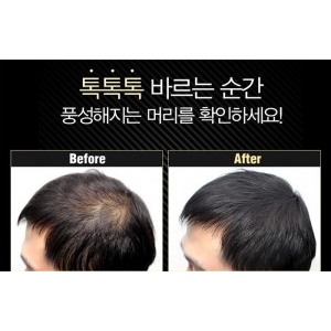 ‘헤어쿠션다슈’ 탈모 완벽커버